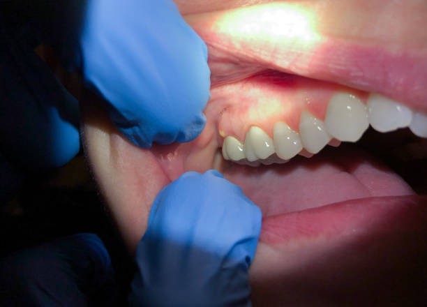 Best Emergency Root Canal Therapy in Winchester, MO